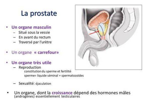 cancers masculins
