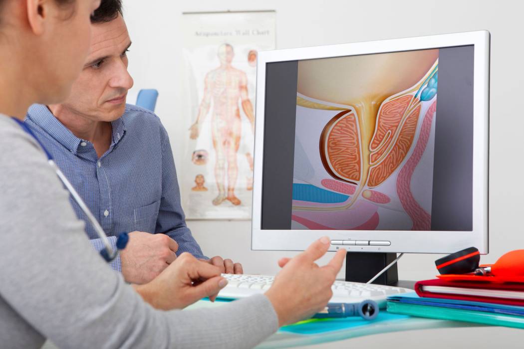 cancers masculins prostate